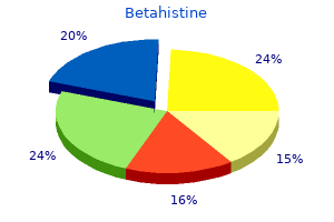 order betahistine