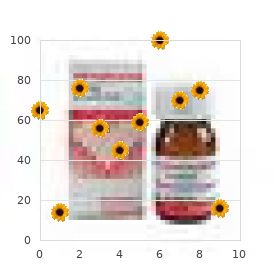 Chromosome 1, monosomy 1q25 q32