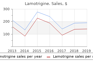 order lamotrigine amex