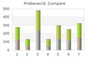 buy generic probenecid line