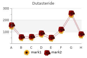 buy dutasteride in united states online