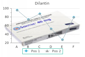 order 100 mg dilantin amex
