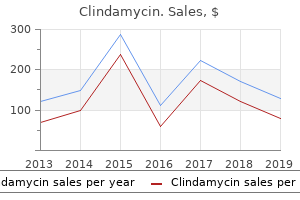 buy 150mg clindamycin with amex