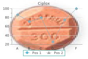 buy ciplox with american express