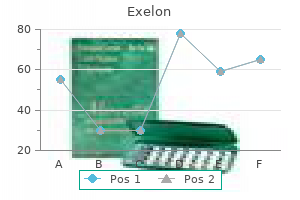 purchase exelon uk