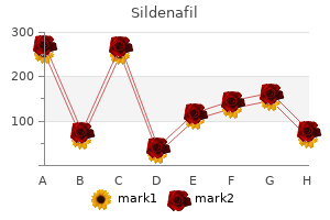 purchase on line sildenafil