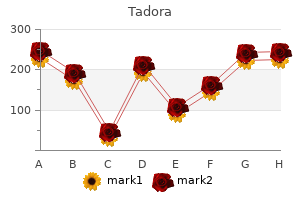 buy tadora online