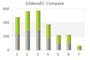 buy discount sildenafil 25 mg on line